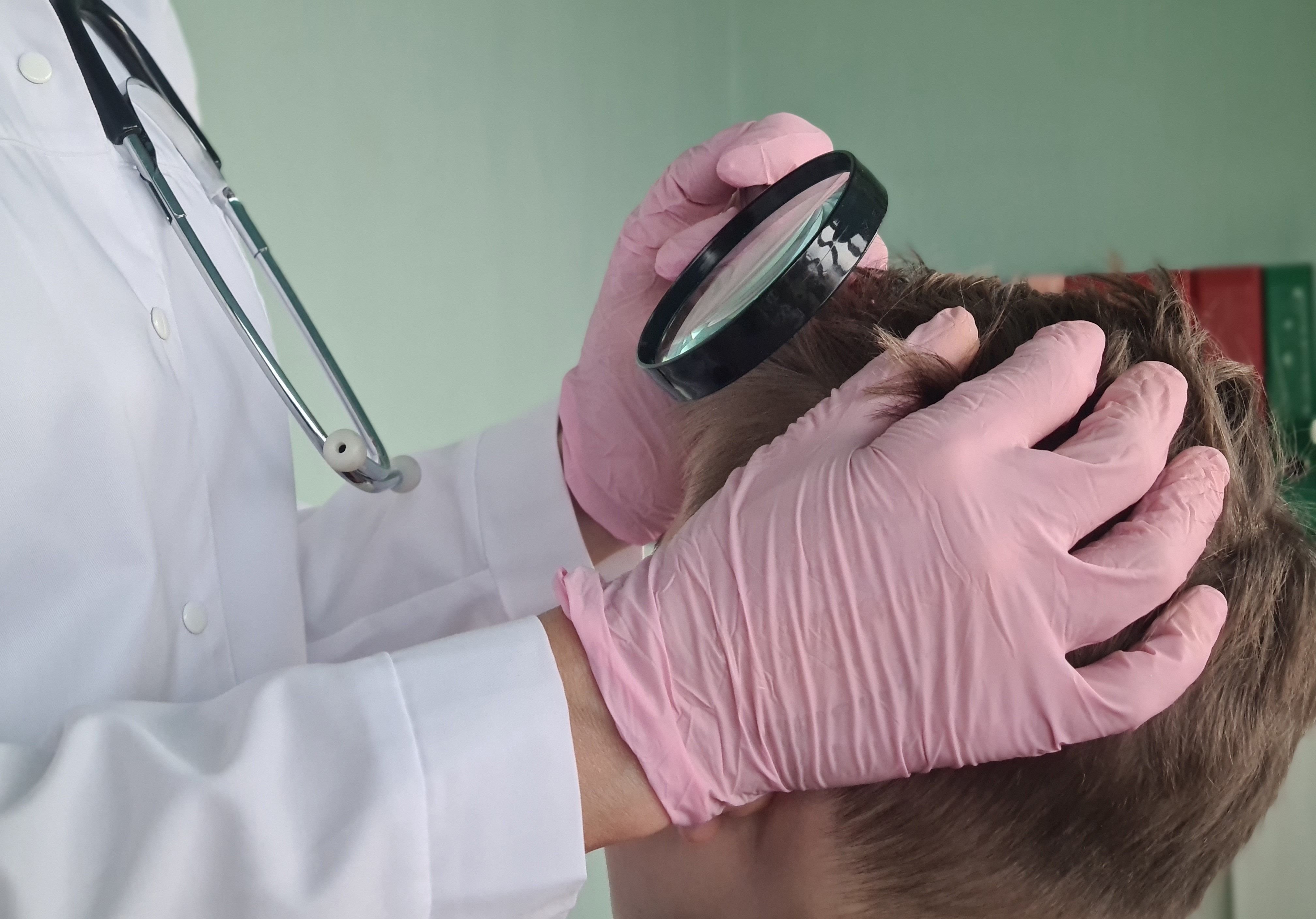 Trichologist examines child scalp.  | Image Credit: Nadzeya - stock.adobe.com