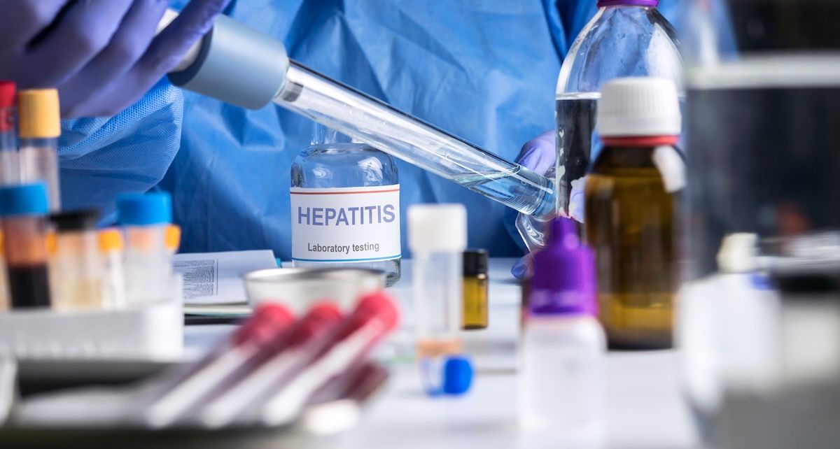 hepatitis laboratory research | Image credit: digicomphoto - stock.adobe.com