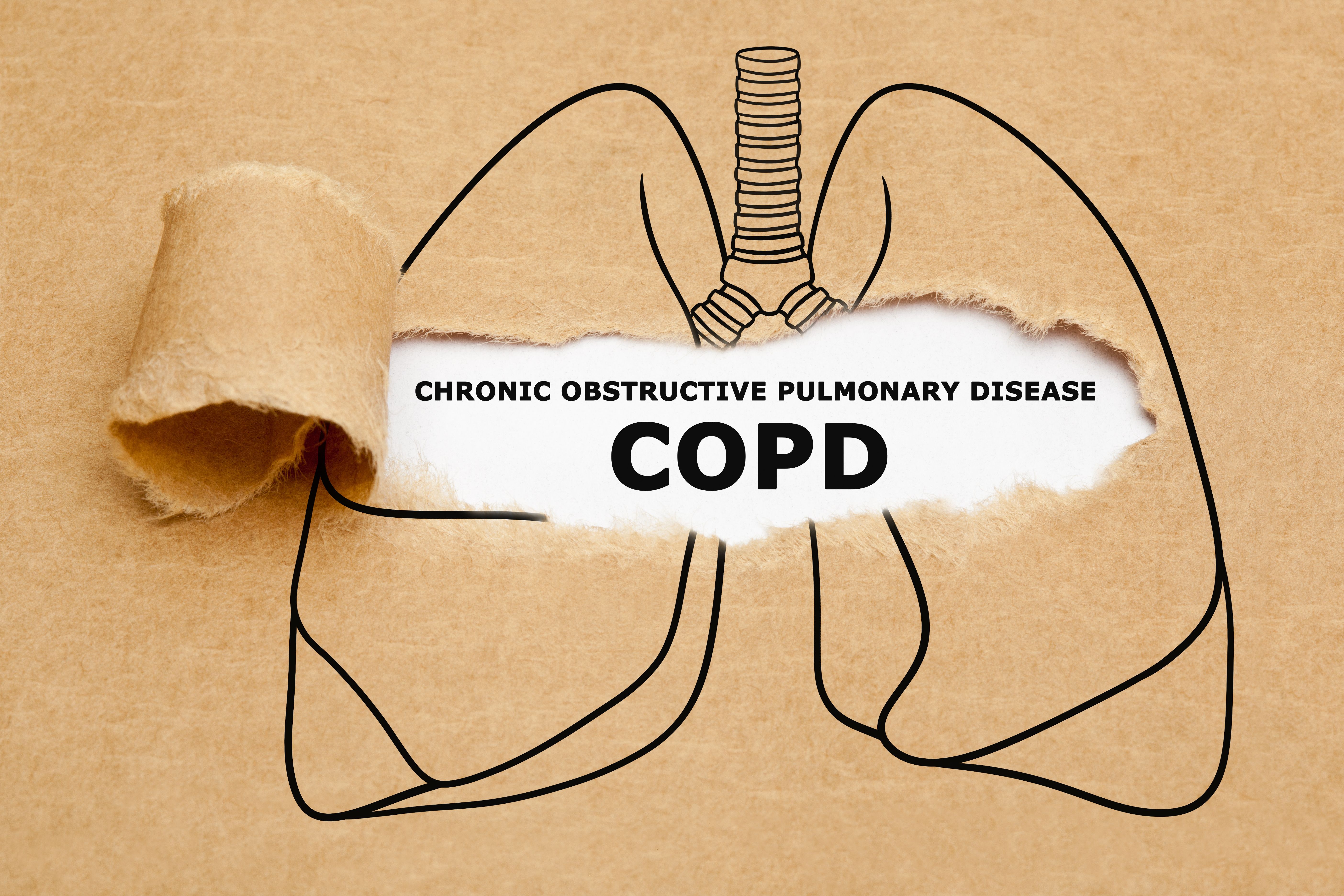 COPD drawing | Image Credit: Ivelin Radkov - stock.adobe.com