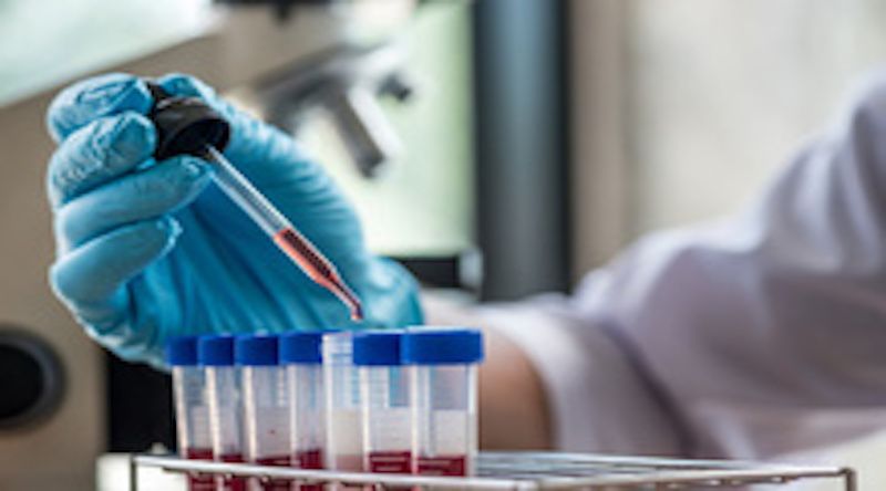 Image of test tubes with blood in a lab