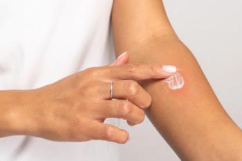 Allergic reaction, itch, allergy, dermatiti concept. | DimaBerlin - stoc.adobe.com