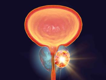 Prostate cancer illustration | Image credit: Dr_Microbe - stock.adobe.com