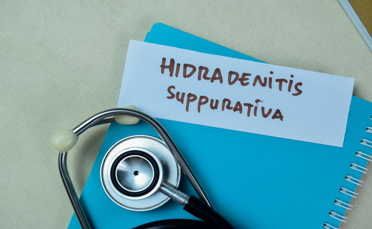 Hidradenitis suppurativa | Image Credit: © syahrir-stock.adobe.com