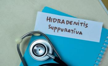 Hidradenitis suppurativa | Image Credit: © syahrir-stock.adobe.com