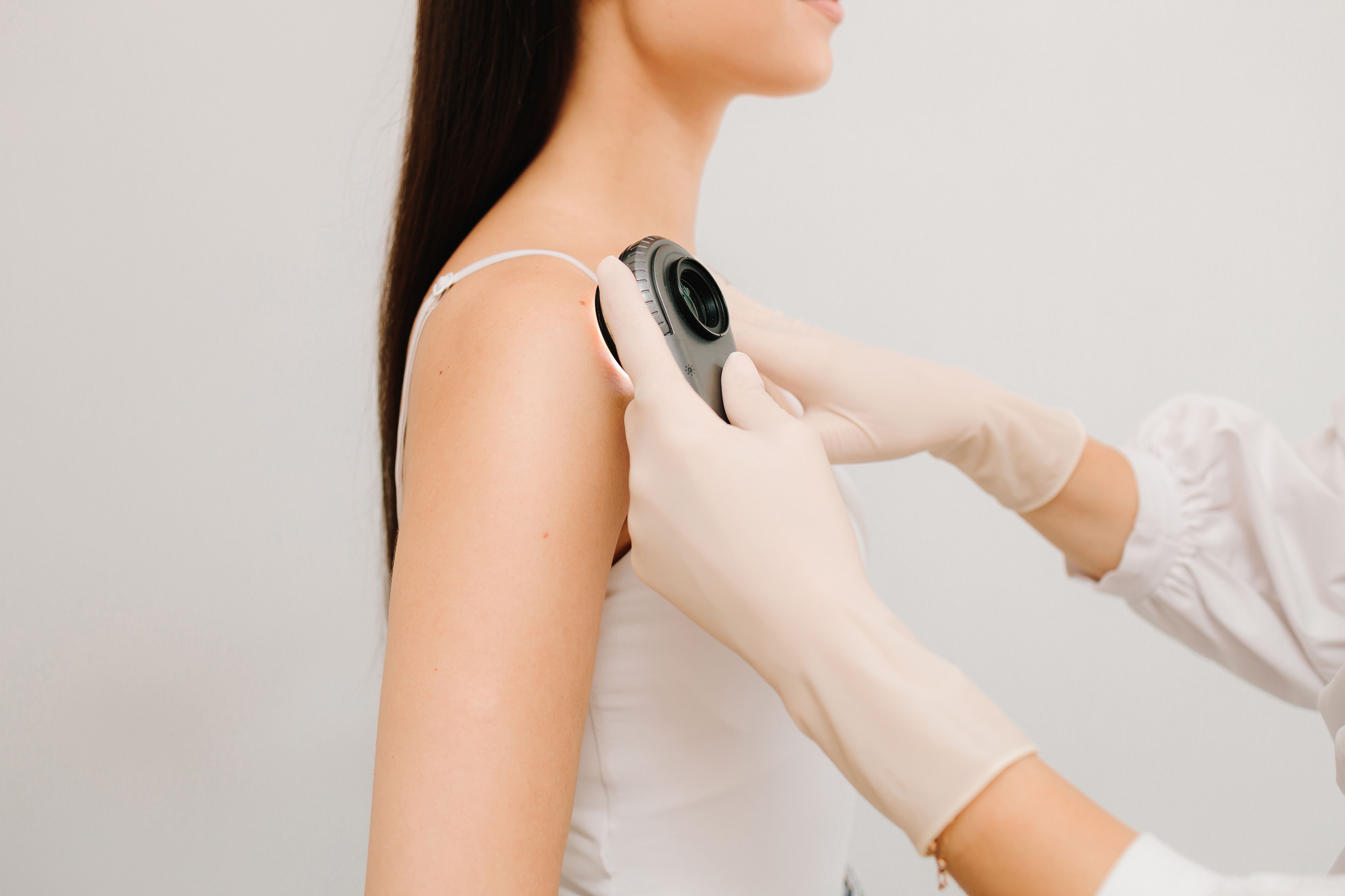 Dermatoscope | Image Credit: Rabizo Anatolii - stock.adobe.com