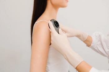 Dermatoscope | Image Credit: Rabizo Anatolii - stock.adobe.com