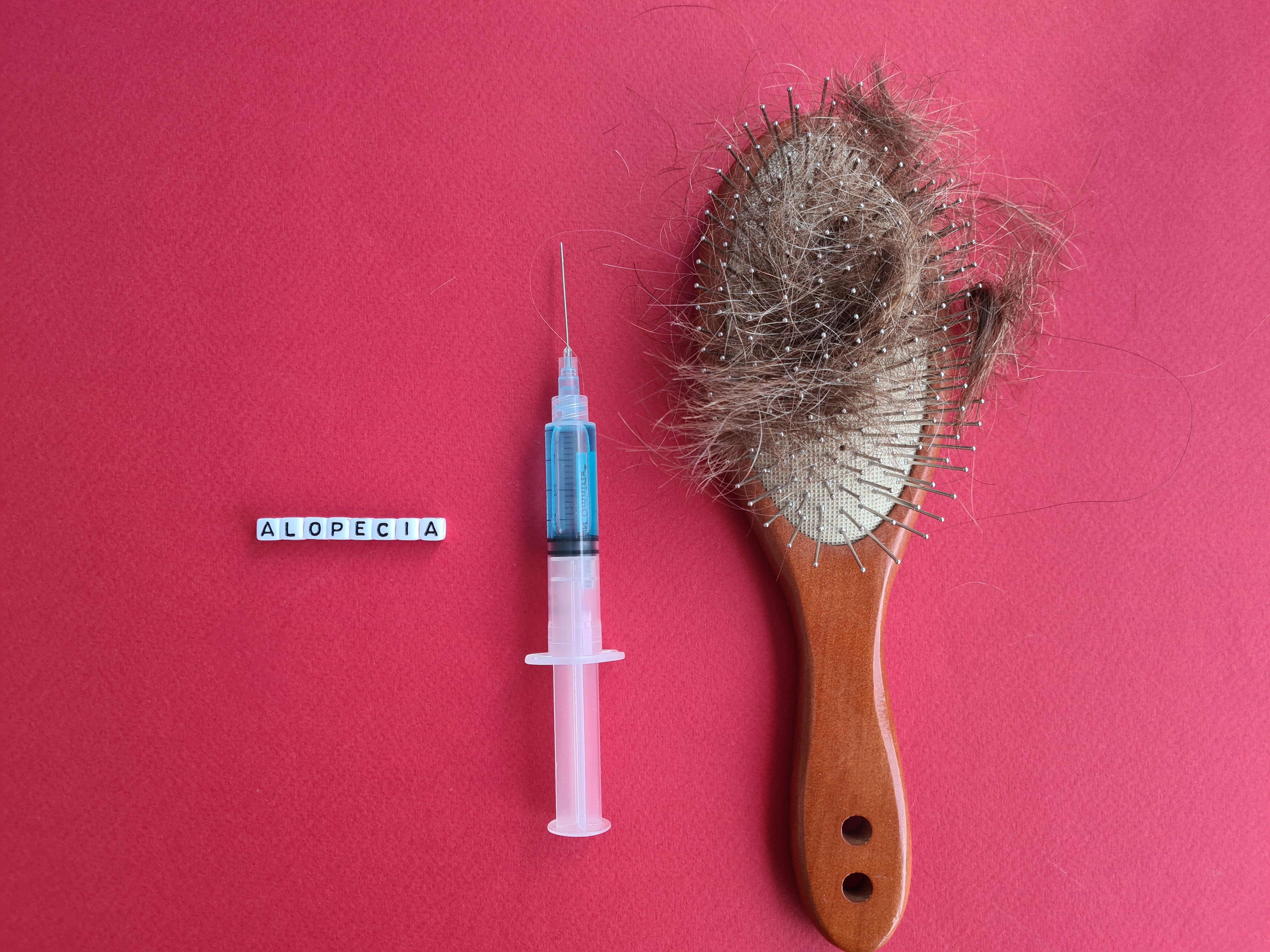 Alopecia hair loss in hair brush, medical syringe | Image Credit: Nadzeya - stock.adobe.com