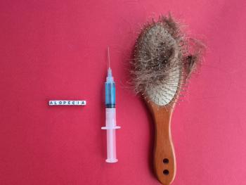 Alopecia hair loss in hair brush, medical syringe | Image Credit: Nadzeya - stock.adobe.com