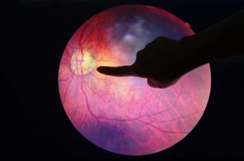 Magnified eye image