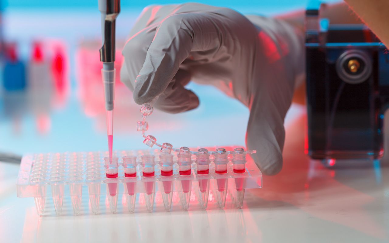 electrophoresis device in a genetics lab to decrypt the genetic code: © luchschenF - stock.adobe.com