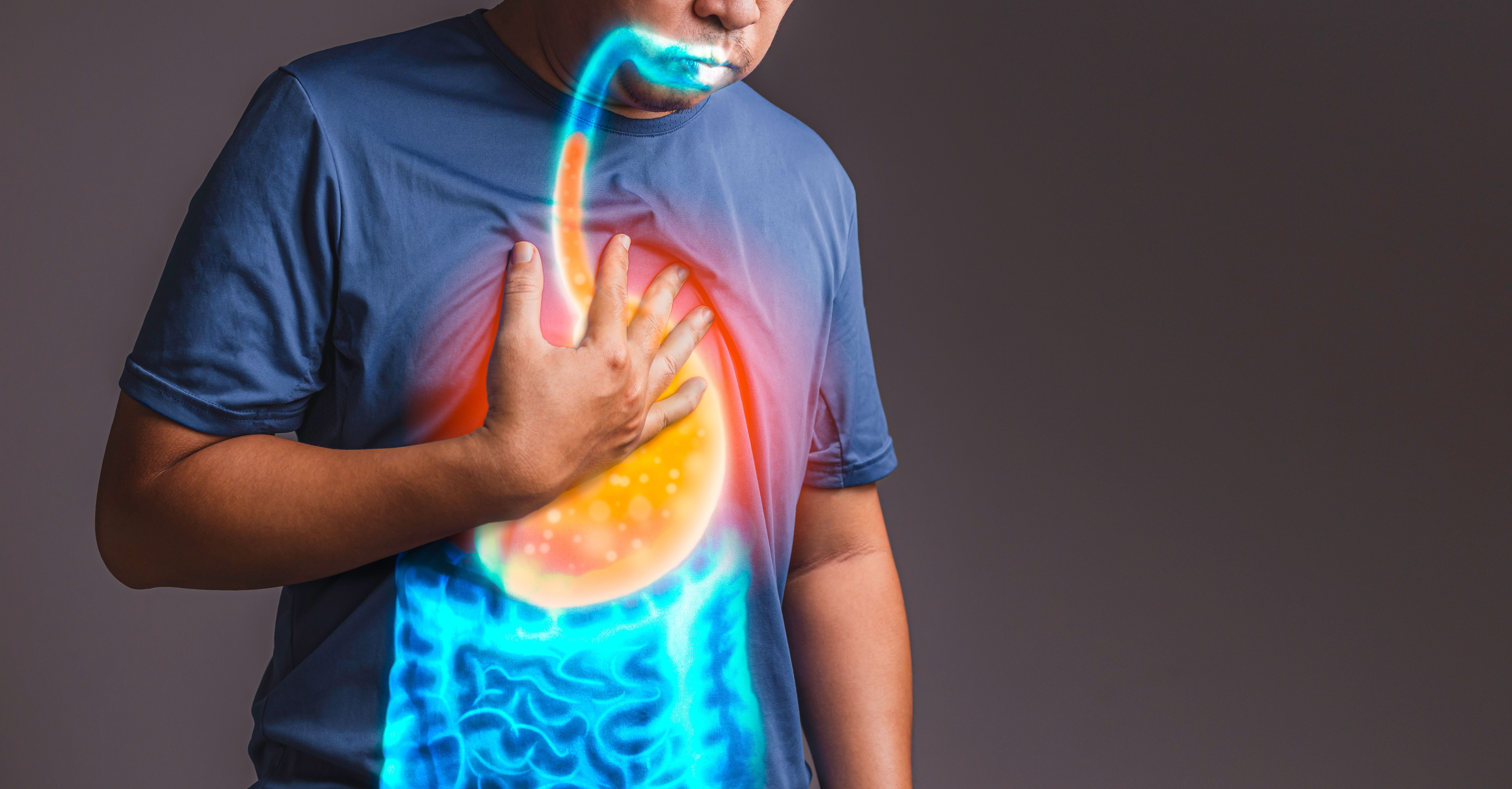 acid reflux | Image credit: Suttipun - stock.adobe.com