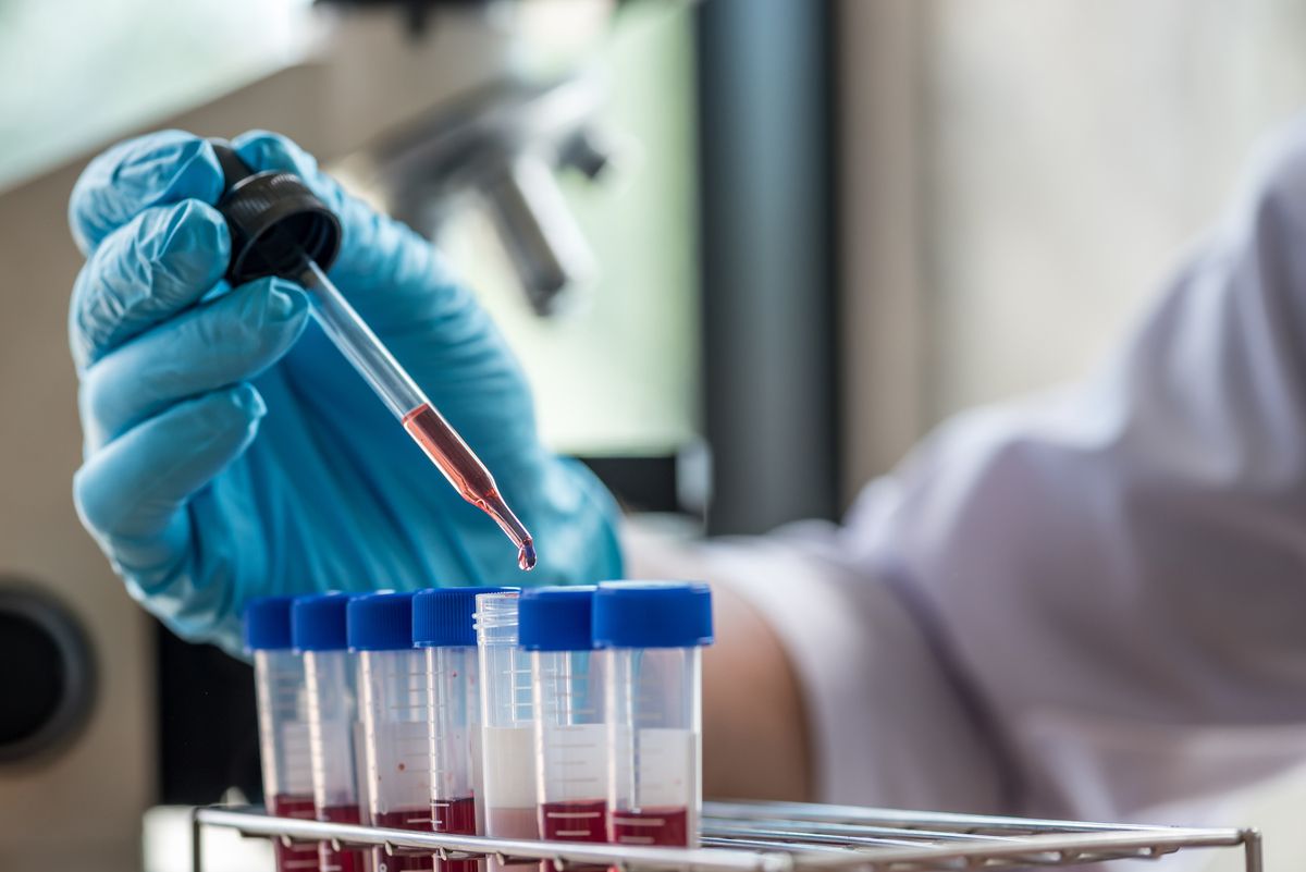 Blood samples in tubes