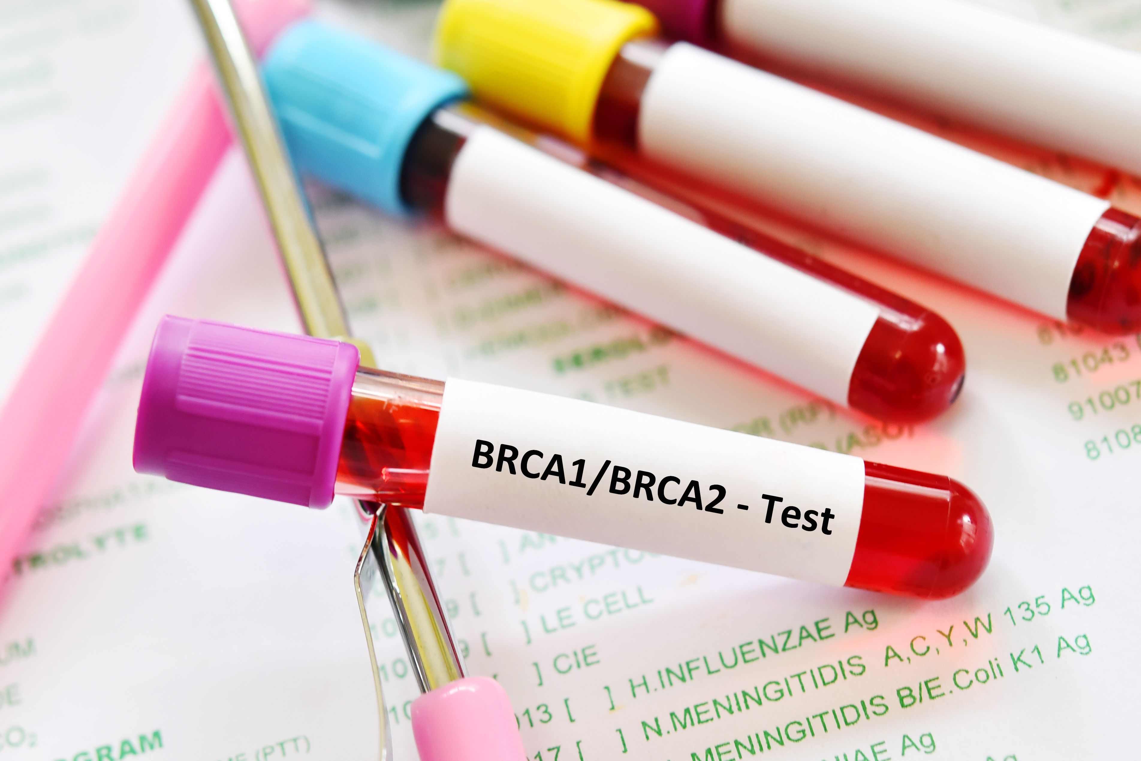 Blood sample for BRCA test | Image Credit: jarun011 - stock.adobe.com