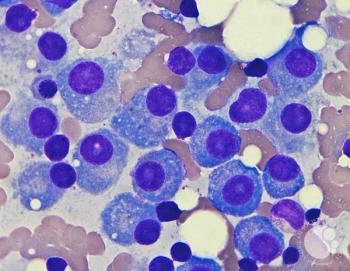 Myeloma cells | Image: ASH image bank
