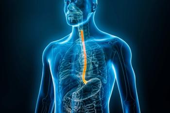 Esophagus inflammation | Image credit: Matthieu - stock.adobe.com