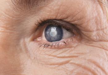 Older woman's eye | Image credit: Africa Studio - stock.adobe.com