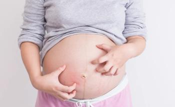 Itchy pregnant belly | Image Credit: © chajamp stock.adobe.com