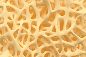 Pfenex Reports Good Results of Biosimilar for Osteoporosis