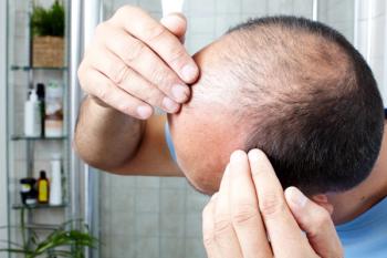 Image of a bald head