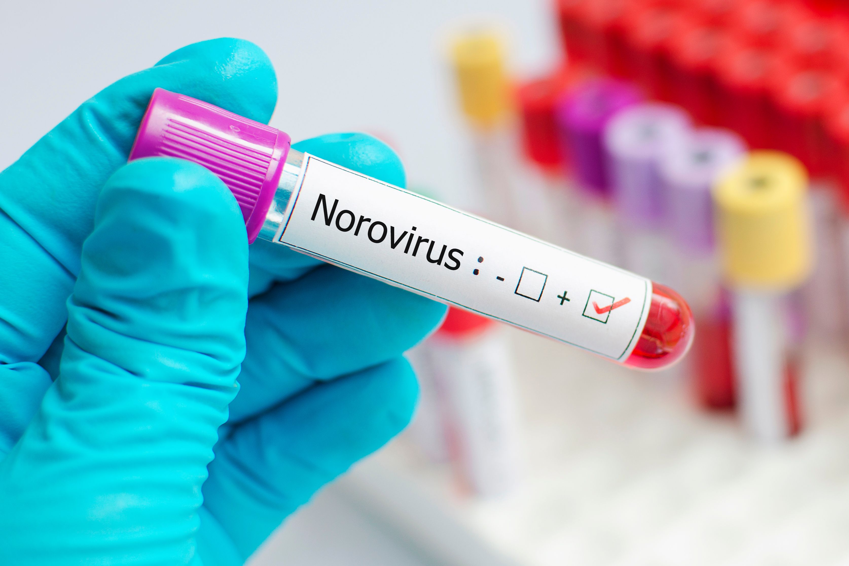 norovirus test | Image credit: jarun011 - stock.adobe.com