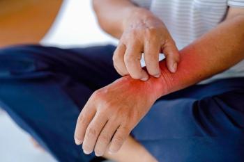 Man scratching a bug bite | Image credit: Oporty786 - stock.adobe.com