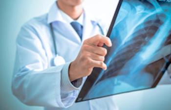 Image of a lung scan