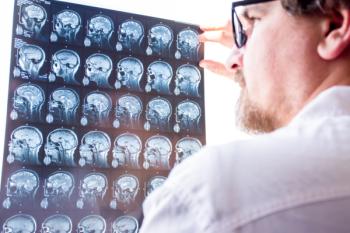 Doctor Evaluating MRI for MS Diagnosis Concept | image credit: shidlovski - stock.adobe.com