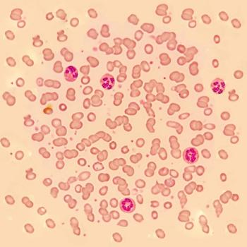 Artistic rendering of autoimmune cells