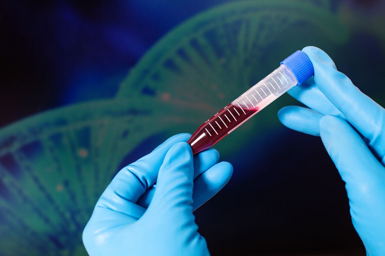 Lab tech holding test tube with blood: curlymary - stock.adobe.com