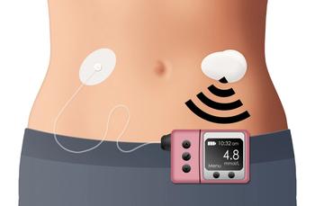 closed loop insulin delivery system
