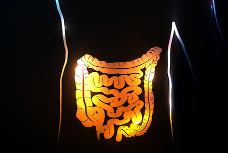 5 Things to Know About Biosimilars and Inflammatory Bowel Disease