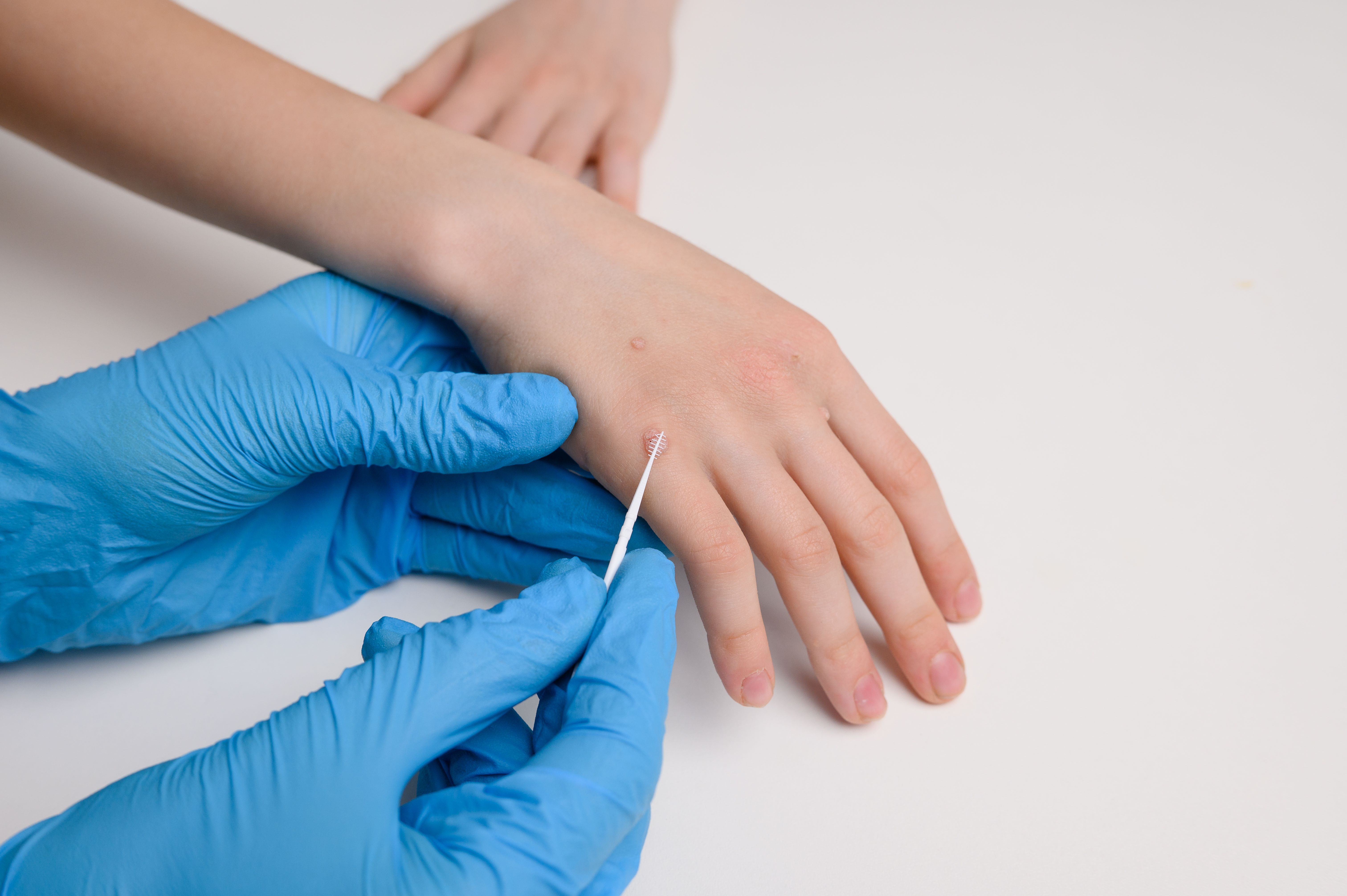 Pediatric derm appointment | Image credit: GRON777 - stock.adobe.com