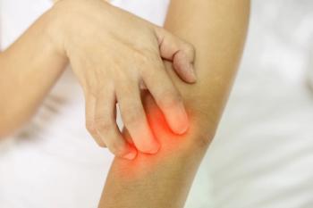 Woman itch hand arm and scratch and have problem with skin,Skincare Concept: © 220 Selfmade studio - stock.adobe.com