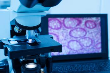 Biopsy | Image credit: arcyto - stock.adobe.com
