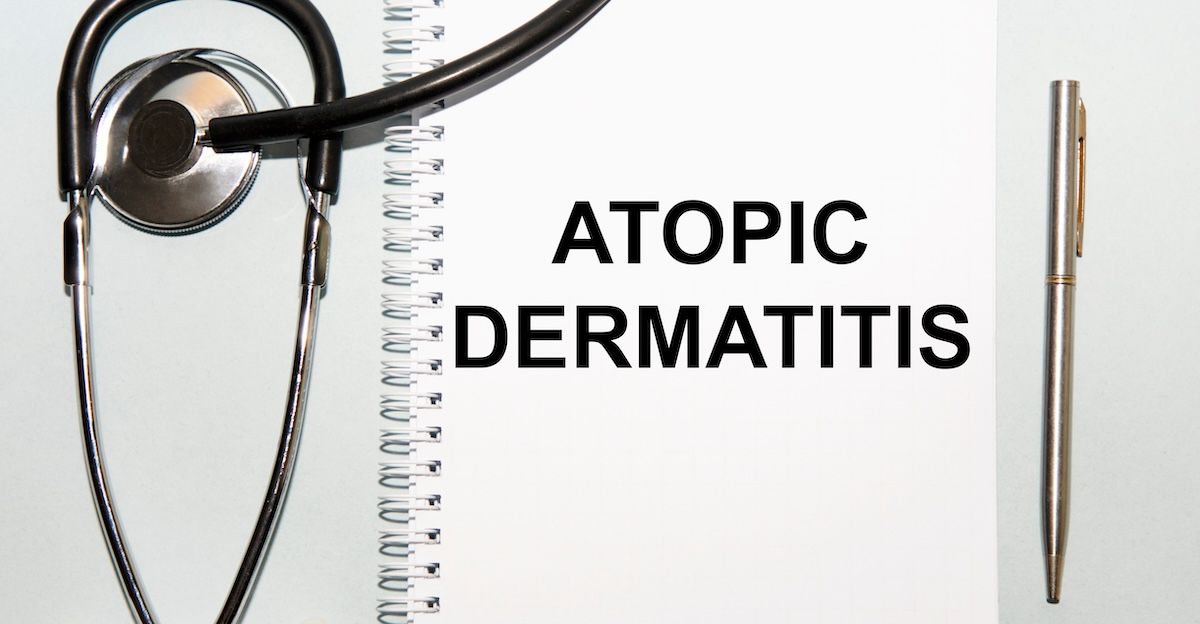 Atopic Dermatitis | Image Credit: Veranika-stock.adobe.com