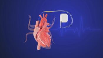 implantable cardioverter | Image Credit: © defibrillator-Silver Place-stock.adobe.com