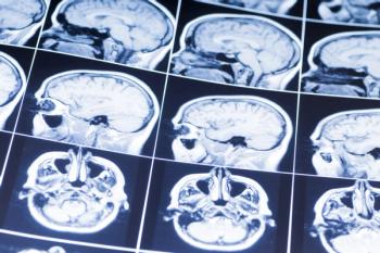 Brain MRI
