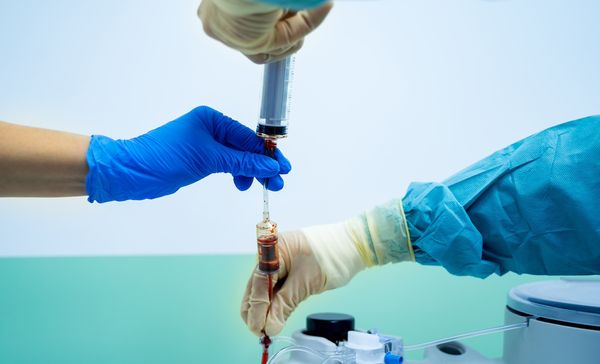 stem cell transplant | Image credit: Vadim - stock.adobe.com