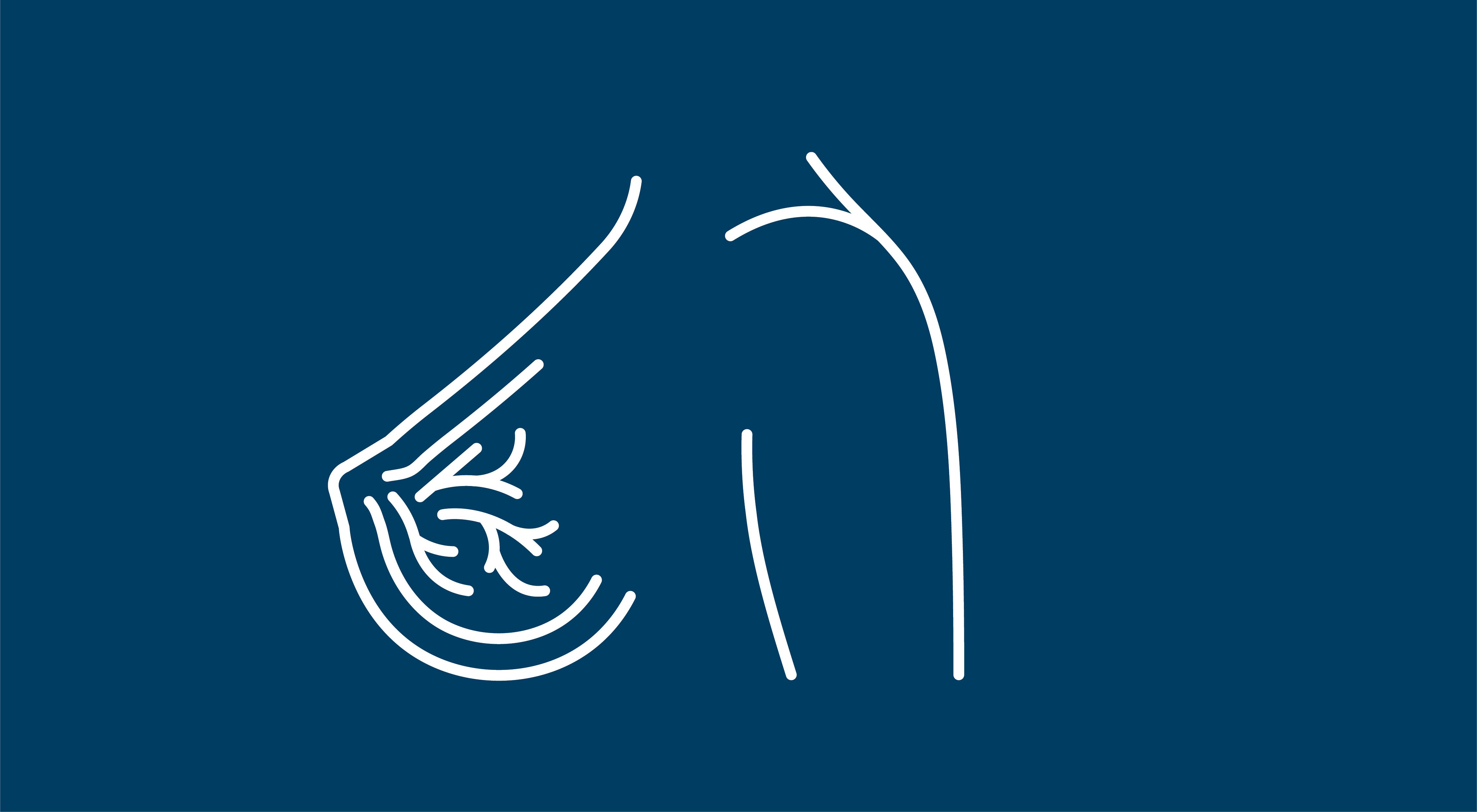 Image depicting breast cancer