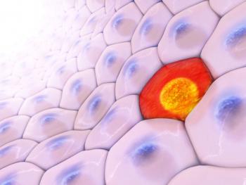Skin cancer cells