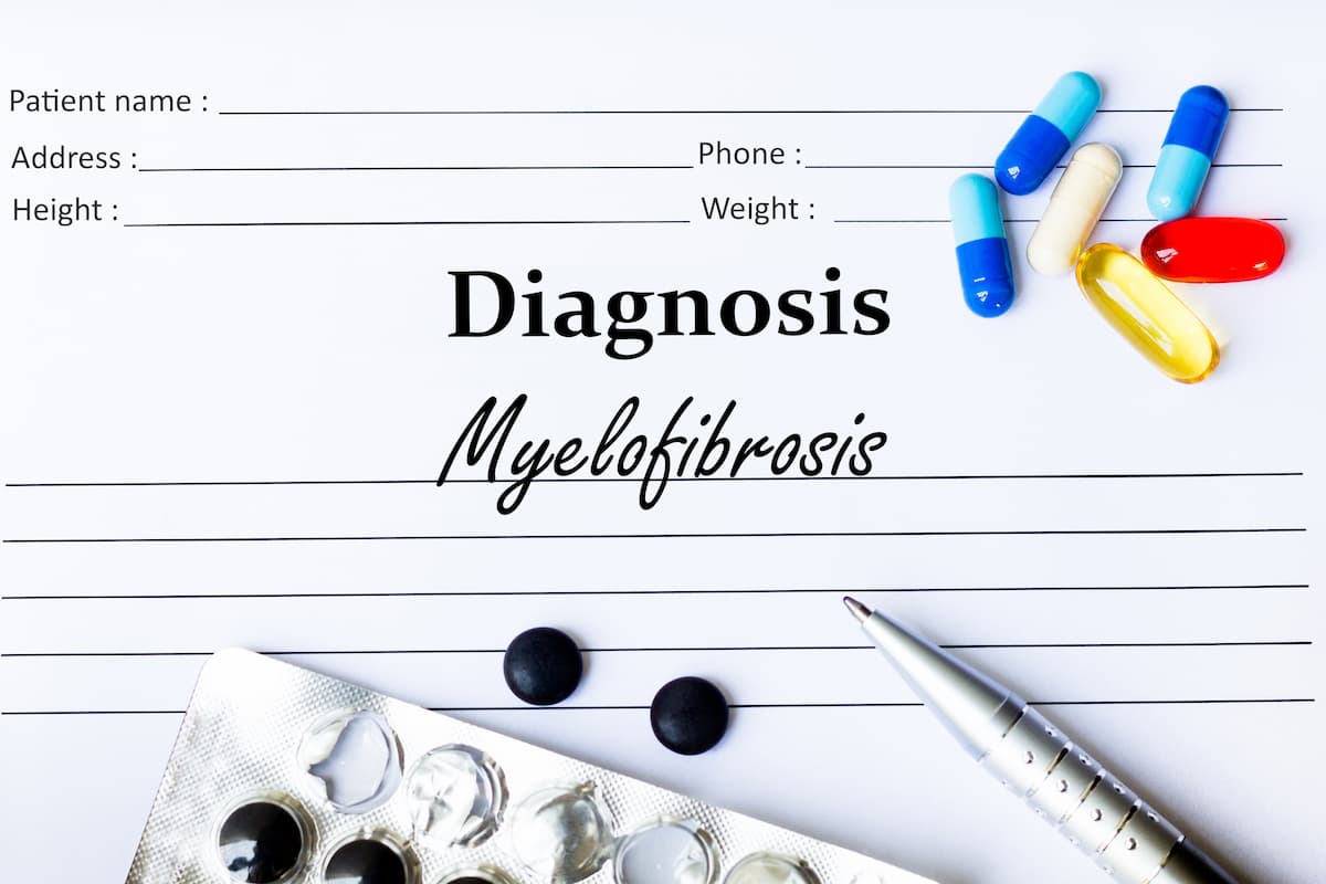 The iRR6 may help identify those who are unlikely to derive long-term benefit from ruxolitinib and could be considered for alternative therapies. | Image credit: mdaros - stock.adobe.com