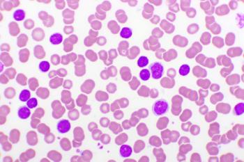 The new research points to the potential of AP-1 and stromal interactions as promising targets to overcome resistance and improve outcomes in CLL. | Image credit: jarun011 - stock.adobe.com