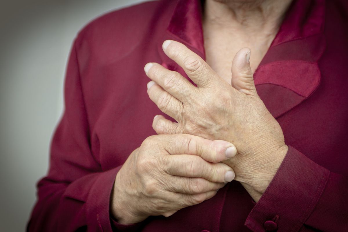 Hands with rheumatoid arthritis