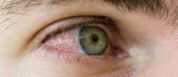 Human eye.