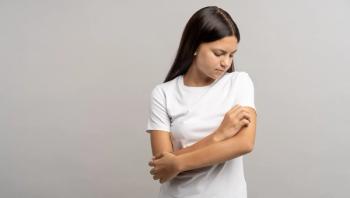 allergy teen | Image credit: DimaBerlin - stock.adobe.com