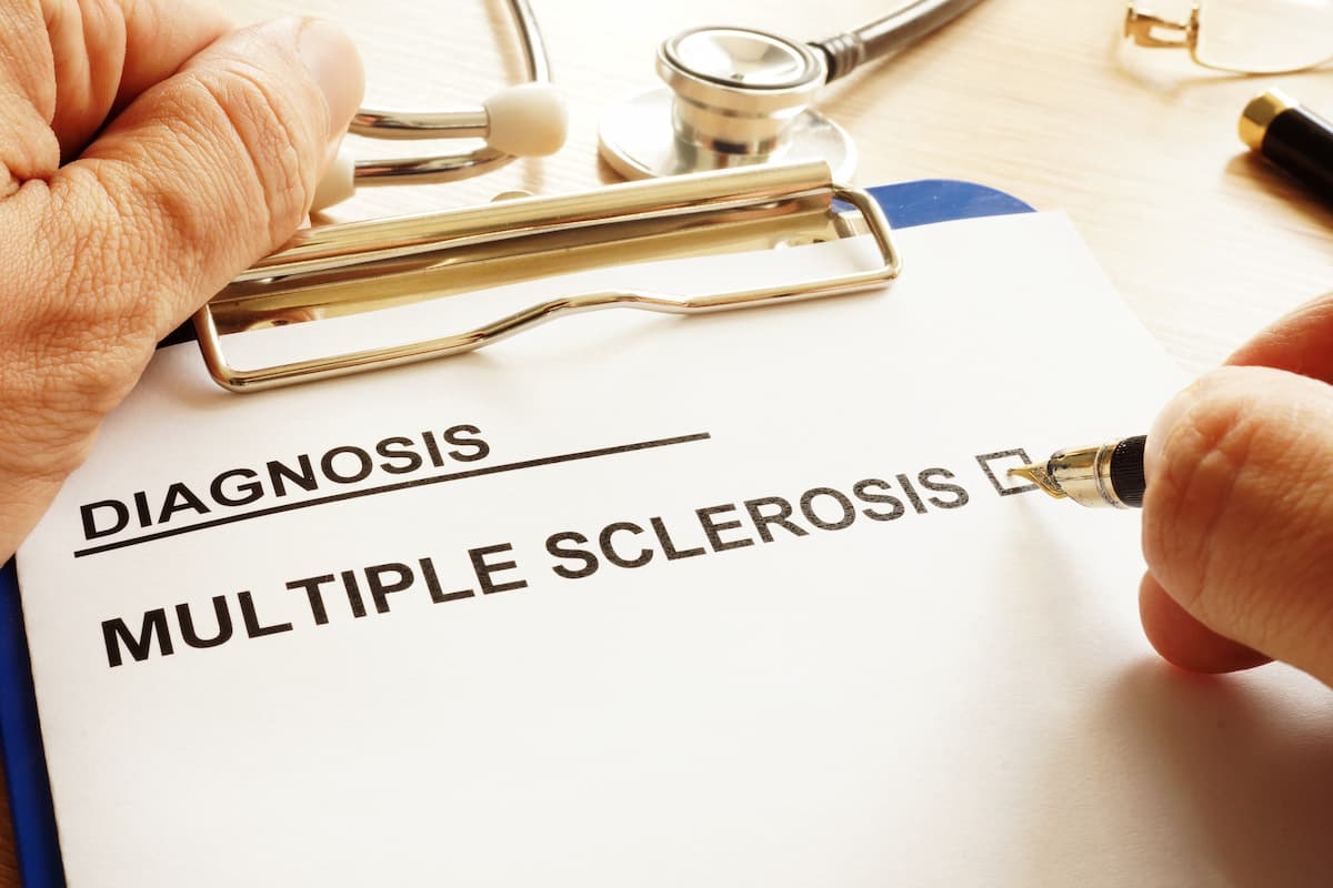 Multiple sclerosis diagnosis | Image credit: Vitalii Vodolazskyi - stock.adobe.com