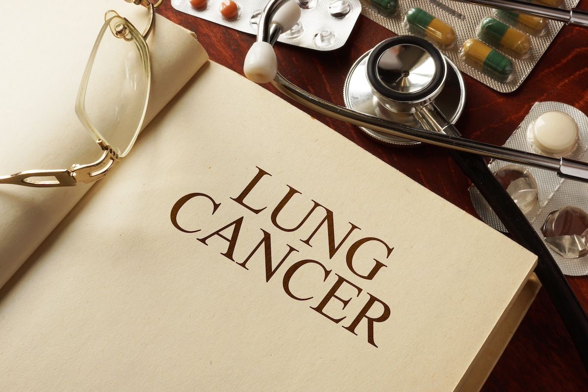 Perioperative nivolumab improves NSCLC survival: CheckMate 77T study Perioperative nivolumab improves NSCLC survival: CheckMate 77T study