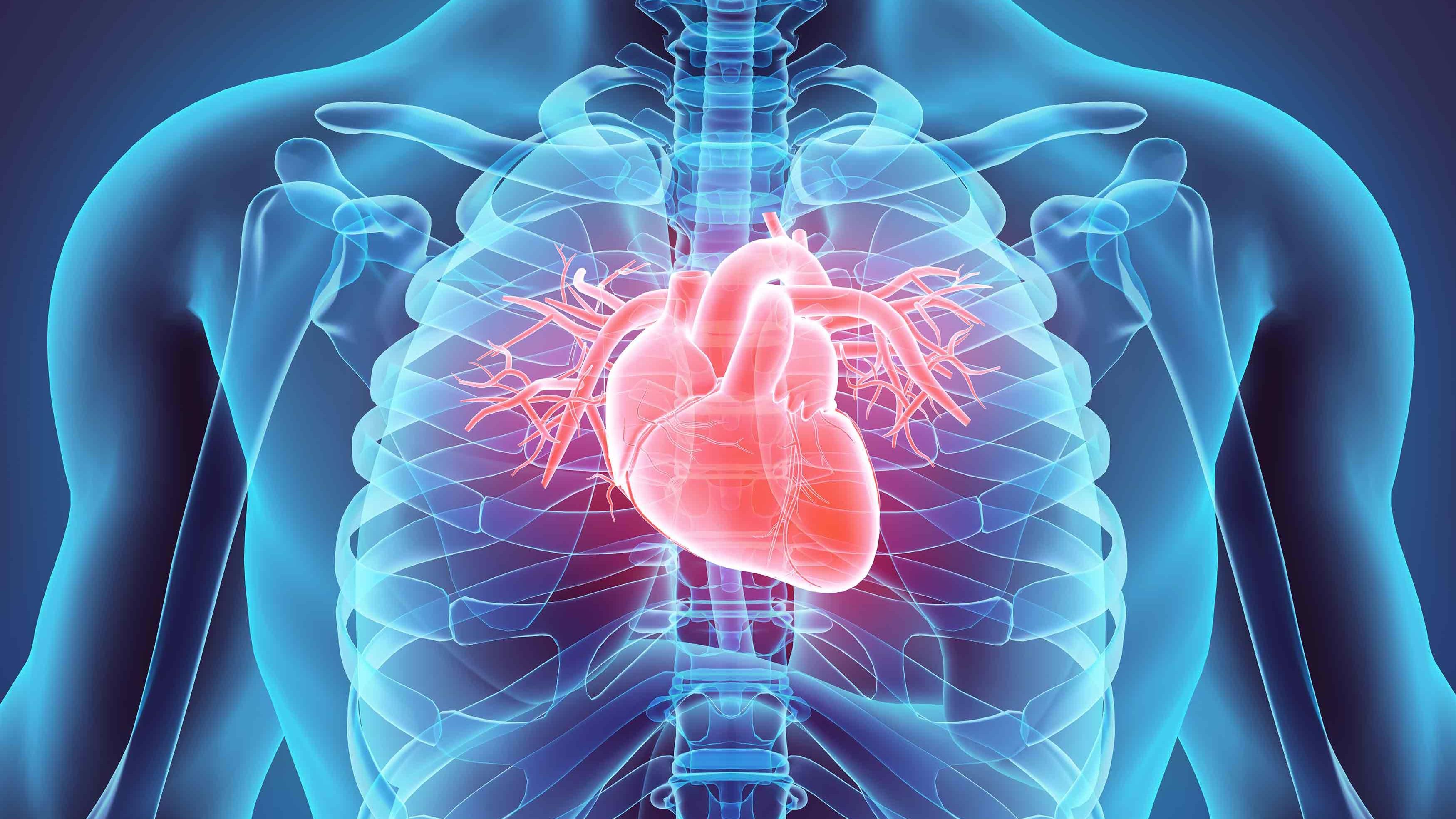 Cual es la etapa final de la fibrosis pulmonar