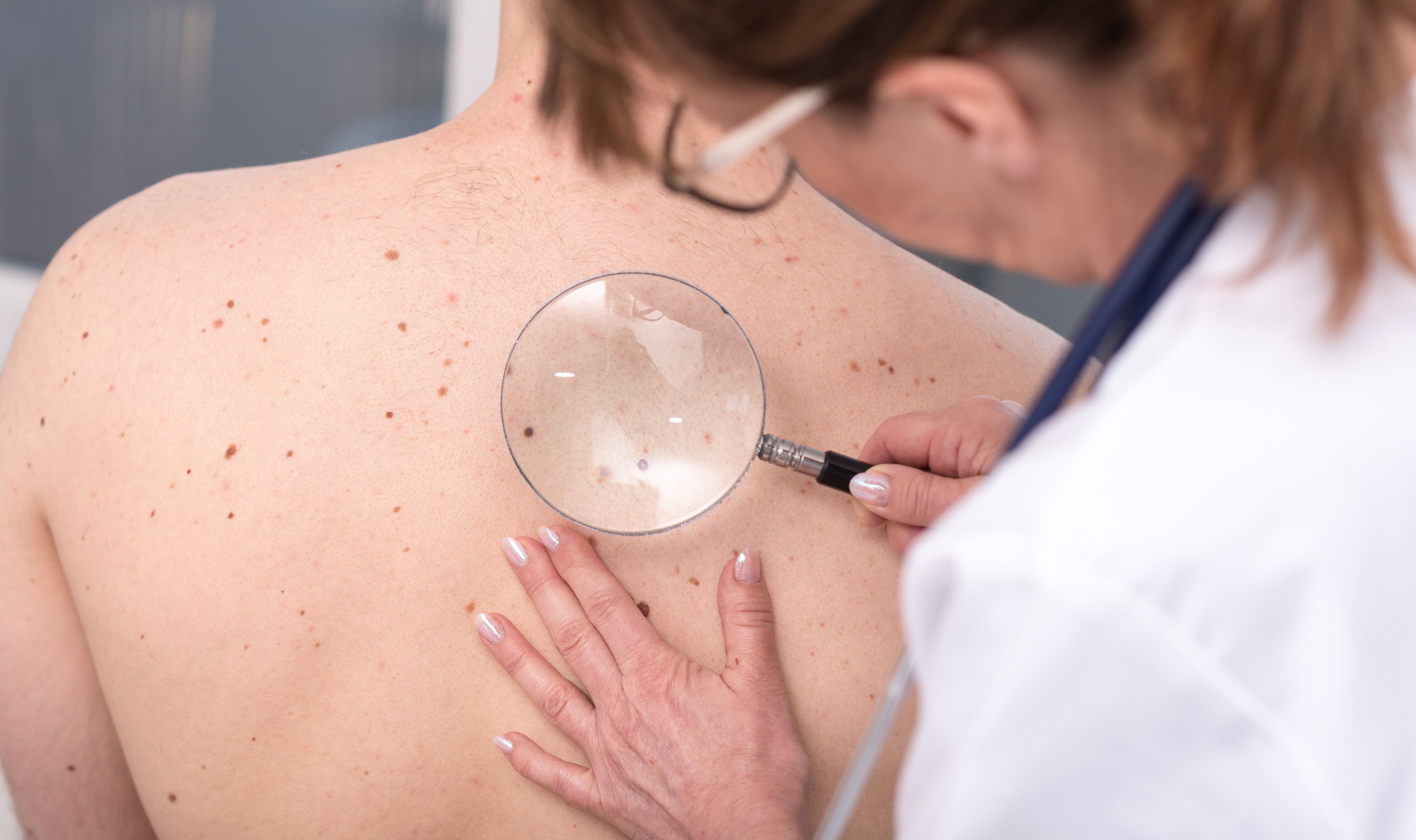 Skin Examination | image credit: thodonal - stock.adobe.come