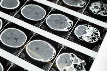 Detailed brain MRI | Image Credit: Cottonbro Studio - pexels.com